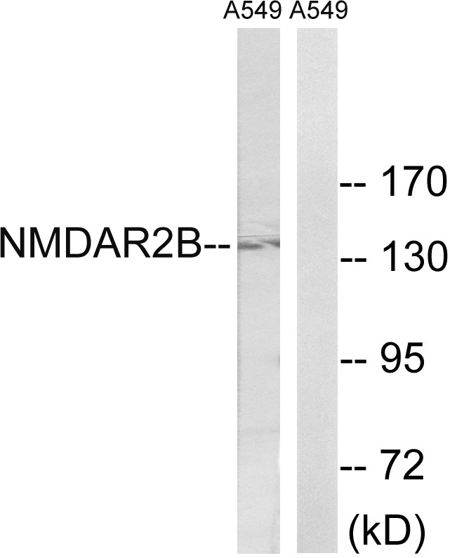 GRIN2B / NMDAR2B / NR2B Antibody - Western blot analysis of lysates from A549 cells, using NMDAR2B Antibody. The lane on the right is blocked with the synthesized peptide.