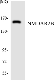 GRIN2B / NMDAR2B / NR2B Antibody - Western blot analysis of the lysates from HUVECcells using NMDAR2B antibody.