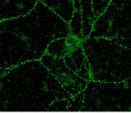 GRIN2B / NMDAR2B / NR2B Antibody - Cultured rat hippocampal neuron immunofluorescence.