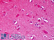 GRIN2B / NMDAR2B / NR2B Antibody - Anti-GRIN2B / NMDAR2B antibody IHC of human brain, cortex neurons. Immunohistochemistry of formalin-fixed, paraffin-embedded tissue after heat-induced antigen retrieval. Antibody concentration 5 ug/ml.  This image was taken for the unconjugated form of this product. Other forms have not been tested.