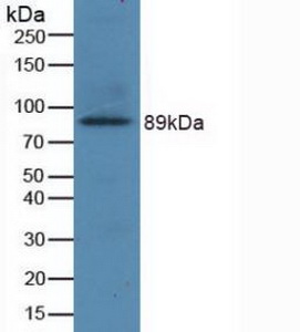 GRIN2B / NMDAR2B / NR2B Antibody - Western Blot; Sample: Recombinant GRIN2B, Human.