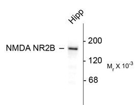 GRIN2B / NMDAR2B / NR2B Antibody - Western blot of 10 ug of rat hippocampal (Hipp) lysate showing specific immunolabeling of the ~180k NR213 subunit of the NMDA receptor.