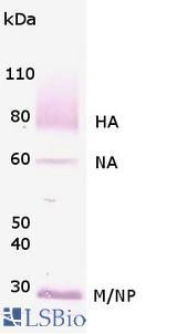 GRIN2B / NMDAR2B / NR2B Antibody - : Formalin-Fixed, Paraffin-Embedded (FFPE)