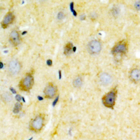 GRIN2B / NMDAR2B / NR2B Antibody - Immunohistochemical analysis of NMDAR2B (pY1336) staining in human brain formalin fixed paraffin embedded tissue section. The section was pre-treated using heat mediated antigen retrieval with sodium citrate buffer (pH 6.0). The section was then incubated with the antibody at room temperature and detected using an HRP conjugated compact polymer system. DAB was used as the chromogen. The section was then counterstained with hematoxylin and mounted with DPX.
