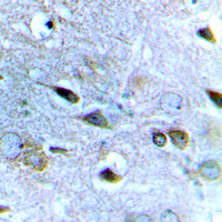 GRIN2B / NMDAR2B / NR2B Antibody - Immunohistochemical analysis of NMDAR2B staining in human brain formalin fixed paraffin embedded tissue section. The section was pre-treated using heat mediated antigen retrieval with sodium citrate buffer (pH 6.0). The section was then incubated with the antibody at room temperature and detected using an HRP conjugated compact polymer system. DAB was used as the chromogen. The section was then counterstained with hematoxylin and mounted with DPX.