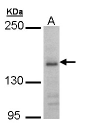 GRIN2B / NMDAR2B / NR2B Antibody - Sample (30 ug of whole cell lysate). A: Hep G2. 5% SDS PAGE. GRIN2B antibody diluted at 1:1000
