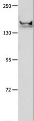 GRIN2B / NMDAR2B / NR2B Antibody - Western blot analysis of Mouse brain tissue, using GRIN2B Polyclonal Antibody at dilution of 1:700.