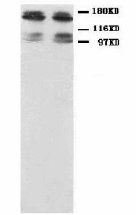 GRIN2B / NMDAR2B / NR2B Antibody -  This image was taken for the unconjugated form of this product. Other forms have not been tested.