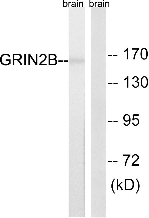 GRIN2B / NMDAR2B / NR2B Antibody - Western blot analysis of extracts from mouse brain cells, using GRIN2B(Ab-1303) antibody.