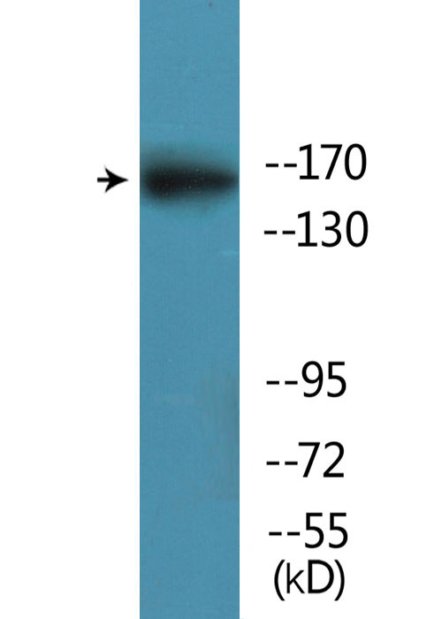GRIN2B / NMDAR2B / NR2B Antibody - Western blot analysis of lysates from mouse brain, using GRIN2B (Phospho-Ser1303) Antibody.