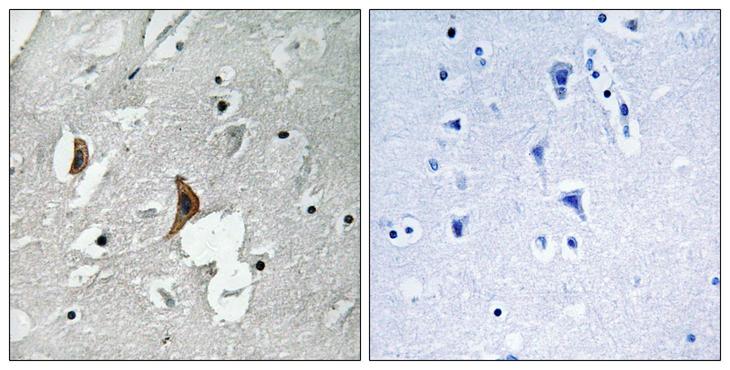 GRIN2B / NMDAR2B / NR2B Antibody - Immunohistochemistry analysis of paraffin-embedded human brain, using NMDAR2B (Phospho-Tyr1336) Antibody. The picture on the right is blocked with the phospho peptide.