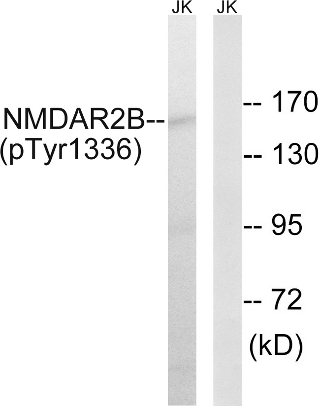 GRIN2B / NMDAR2B / NR2B Antibody - Western blot analysis of lysates from Jurkat cells treated with TNF 20ng/ml 30', using NMDAR2B (Phospho-Tyr1336) Antibody. The lane on the right is blocked with the phospho peptide.