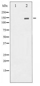 GRIN2B / NMDAR2B / NR2B Antibody - Western blot of NMDAR2B phosphorylation expression in TNF treated Jurkat whole cell lysates,The lane on the left is treated with the antigen-specific peptide.