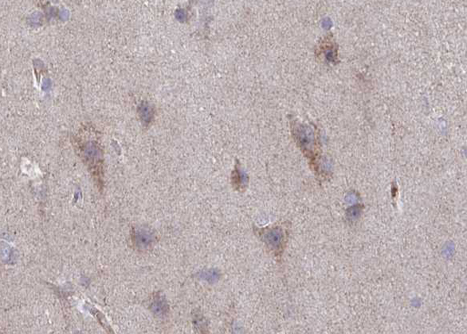 GRIN2B / NMDAR2B / NR2B Antibody - 1:100 staining human brain tissue by IHC-P. The tissue was formaldehyde fixed and a heat mediated antigen retrieval step in citrate buffer was performed. The tissue was then blocked and incubated with the antibody for 1.5 hours at 22°C. An HRP conjugated goat anti-rabbit antibody was used as the secondary.
