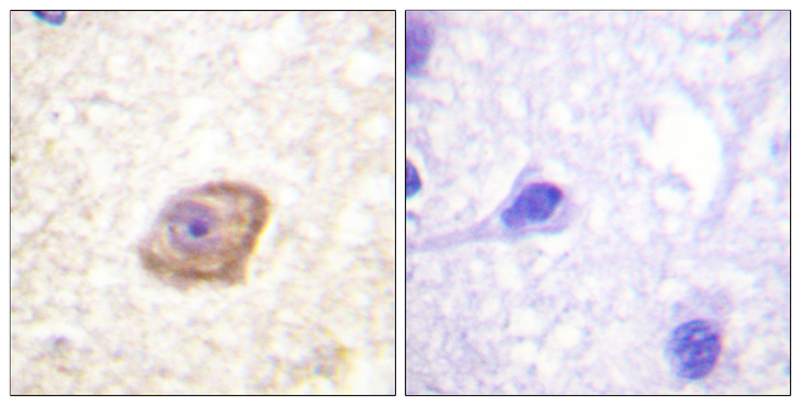 GRIN2B / NMDAR2B / NR2B Antibody - Immunohistochemistry analysis of paraffin-embedded human brain, using NMDAR2B (Phospho-Tyr1474) Antibody. The picture on the right is blocked with the phospho peptide.