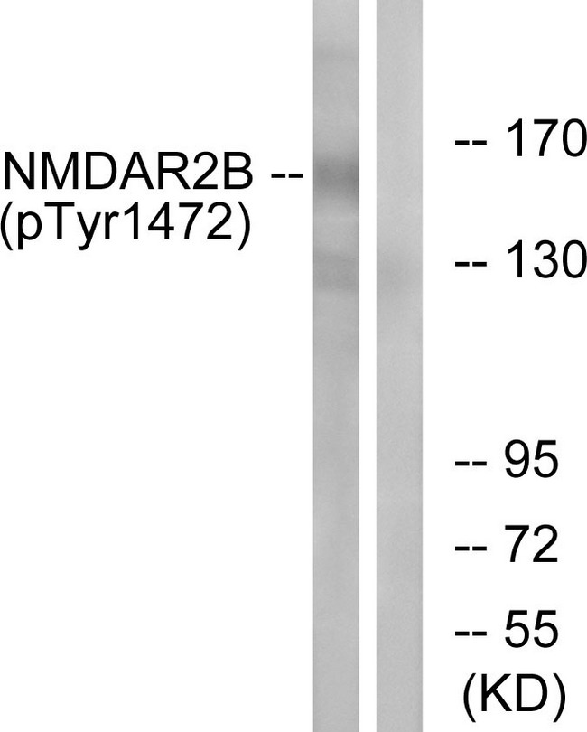 GRIN2B / NMDAR2B / NR2B Antibody - Western blot analysis of lysates from Jurkat cells treated with UV 15', using NMDAR2B (Phospho-Tyr1474) Antibody. The lane on the right is blocked with the phospho peptide.