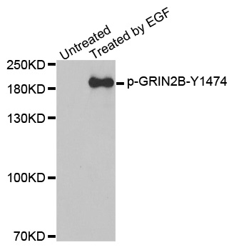 GRIN2B / NMDAR2B / NR2B Antibody - Western blot analysis of extracts from A431 cells.