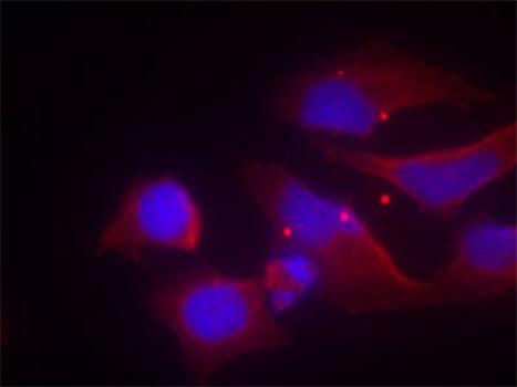 GRIN2B / NMDAR2B / NR2B Antibody - Immunofluorescence staining of methanol-fixed Hela cells.