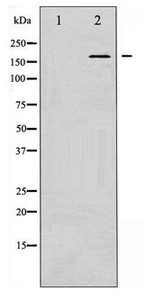GRIN2B / NMDAR2B / NR2B Antibody - Western blot of NMDAR2B phosphorylation expression in UV treated Jurkat whole cell lysates,The lane on the left is treated with the antigen-specific peptide.