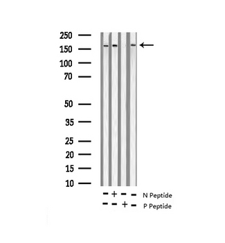 GRIN2B / NMDAR2B / NR2B Antibody - Western blot analysis of Phospho-NMDAR2B (Tyr1474) expression in various lysates