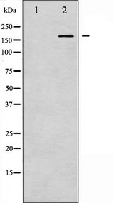 GRIN2B / NMDAR2B / NR2B Antibody - Western blot analysis of NMDAR2B phosphorylation expression in UV treated Jurkat whole cells lysates. The lane on the left is treated with the antigen-specific peptide.