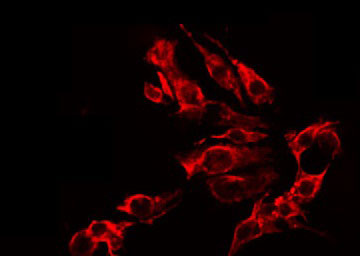 GRIN2B / NMDAR2B / NR2B Antibody - Staining HeLa cells by IF/ICC. The samples were fixed with PFA and permeabilized in 0.1% Triton X-100, then blocked in 10% serum for 45 min at 25°C. The primary antibody was diluted at 1:200 and incubated with the sample for 1 hour at 37°C. An Alexa Fluor 594 conjugated goat anti-rabbit IgG (H+L) Ab, diluted at 1/600, was used as the secondary antibody.