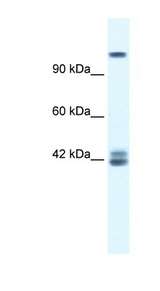 GRIN2C / NMDAR2C / NR2C Antibody - GRIN2C / NMDAR2C antibody Western blot of Jurkat lysate. This image was taken for the unconjugated form of this product. Other forms have not been tested.