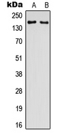 GRIN2D / NMDAR2D / NR2D Antibody - Western blot analysis of NMDAR2D expression in HEK293T (A); HepG2 (B) whole cell lysates.
