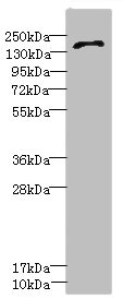 GRIN2D / NMDAR2D / NR2D Antibody - Western blot All Lanes: GRIN2D antibody IgG at 3.65ug/ml+ HepG-2 whole cell lysate Secondary Goat polyclonal to rabbit IgG at 1/10000 dilution Predicted band size: 144 kDa Observed band size: 144 kDa