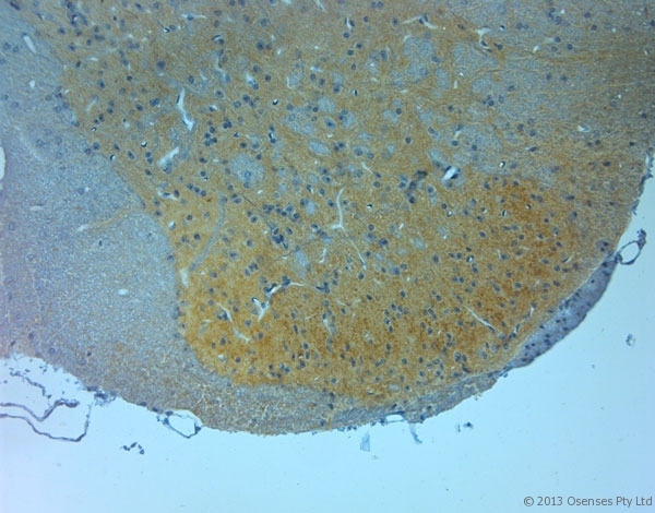 GRIN3A / NR3A Antibody - Rabbit antibody to NMDAR3A (990-1040). IHC on paraffin sections of rat spinal cord tissue using Rabbit antibody to NMDAR3A (990-1040). HIER: 1 mM EDTA, pH 8 for 20 min using Thermo PT Module. Blocking: 0.2% LFDM in TBST filtered through a 0.2 micron filter. Detection was done using Novolink HRP polymer from Leica following manufacturer's instructions. Primary antibody: dilution 1:1000, incubated 30 min at RT (using Autostainer). Sections were counterstained with Harris Hematoxylin.