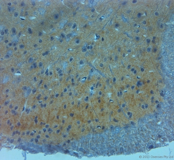 GRIN3A / NR3A Antibody - Rabbit antibody to NMDAR3A (990-1040). IHC on paraffin sections of rat spinal cord tissue using Rabbit antibody to NMDAR3A (990-1040). HIER: 1 mM EDTA, pH 8 for 20 min using Thermo PT Module. Blocking: 0.2% LFDM in TBST filtered through a 0.2 micron filter. Detection was done using Novolink HRP polymer from Leica following manufacturer's instructions. Primary antibody: dilution 1:1000, incubated 30 min at RT (using Autostainer). Sections were counterstained with Harris Hematoxylin.