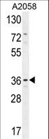 GRINA Antibody - GRINA Antibody western blot of A2058 cell line lysates (35 ug/lane). The GRINA antibody detected the GRINA protein (arrow).