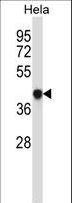 GRINA Antibody - GRINA Antibody western blot of HeLa cell line lysates (35 ug/lane). The GRINA antibody detected the GRINA protein (arrow).