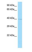 GRINA Antibody - GRINA antibody Western Blot of NCI-H226 cell lysate.  This image was taken for the unconjugated form of this product. Other forms have not been tested.