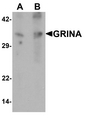 GRINA Antibody - Western blot analysis of GRINA in human testis tissue lysate with GRINA antibody at (A) 1 and (B) 2 ug/ml.