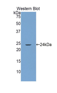 GRIP1 Antibody - Western blot of recombinant GRIP1.  This image was taken for the unconjugated form of this product. Other forms have not been tested.
