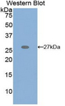 GRIP1 Antibody - Western blot of recombinant GRIP1.  This image was taken for the unconjugated form of this product. Other forms have not been tested.