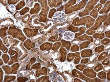GRIP1 Antibody - Anti-GRIP1 antibody used in IHC (Formalin-fixed paraffin-embedded sections).