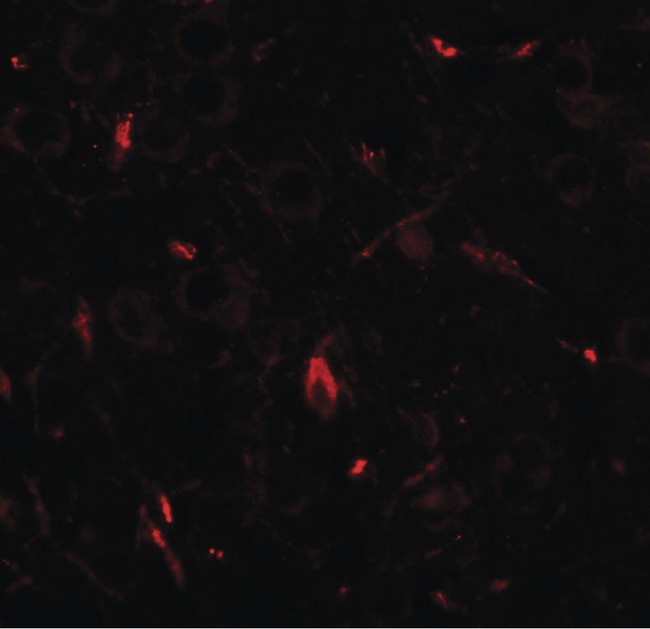 GRIP1 Antibody - Immunofluorescence of GRIP1 in rat brain tissue with GRIP1 antibody at 20 ug/ml.