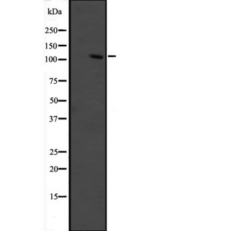 GRIP1 Antibody - Western blot analysis of GRIP1 expression in fetal muscle lysate. The lane on the left is treated with the antigen-specific peptide.
