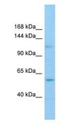 GRIP2 Antibody - GRIP2 antibody Western Blot of COLO205.  This image was taken for the unconjugated form of this product. Other forms have not been tested.