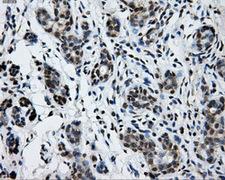 GRIPAP1 / GRASP1 Antibody - Immunohistochemical staining of paraffin-embedded breast tissue using anti-GRIPAP1 mouse monoclonal antibody. (Dilution 1:50).