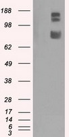 GRIPAP1 / GRASP1 Antibody - HEK293T cells were transfected with the pCMV6-ENTRY control (Left lane) or pCMV6-ENTRY GRIPAP1 (Right lane) cDNA for 48 hrs and lysed. Equivalent amounts of cell lysates (5 ug per lane) were separated by SDS-PAGE and immunoblotted with anti-GRIPAP1.