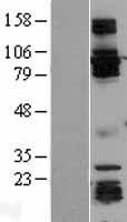 GRIPAP1 / GRASP1 Protein - Western validation with an anti-DDK antibody * L: Control HEK293 lysate R: Over-expression lysate