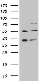 GRK4 Antibody - HEK293T cells were transfected with the pCMV6-ENTRY control. (Left lane) or pCMV6-ENTRY GRK4. (Right lane) cDNA for 48 hrs and lysed. Equivalent amounts of cell lysates. (5 ug per lane) were separated by SDS-PAGE and immunoblotted with anti-GRK4.