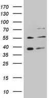 GRK4 Antibody - HEK293T cells were transfected with the pCMV6-ENTRY control (Left lane) or pCMV6-ENTRY GRK4 (Right lane) cDNA for 48 hrs and lysed. Equivalent amounts of cell lysates (5 ug per lane) were separated by SDS-PAGE and immunoblotted with anti-GRK4.