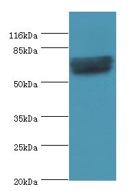 GRK4 Antibody - Western blot. All lanes: GRK4 antibody at 2 ug/ml+Jurkat whole cell lysate. Secondary antibody: goat polyclonal to rabbit at 1:10000 dilution. Predicted band size: 67 kDa. Observed band size: 67 kDa.  This image was taken for the unconjugated form of this product. Other forms have not been tested.
