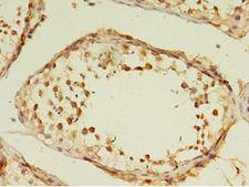 GRK4 Antibody - Immunohistochemistry of paraffin-embedded human testis using antibody at 1:100 dilution.  This image was taken for the unconjugated form of this product. Other forms have not been tested.