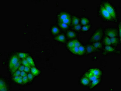 GRK4 Antibody - Immunofluorescent analysis of PC-3 cells using GRK4 Antibody at dilution of 1:100 and Alexa Fluor 488-congugated AffiniPure Goat Anti-Rabbit IgG(H+L)