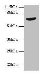 GRK4 Antibody - Western blot All lanes: GRK4 antibody at 2µg/ml + Jurkat whole cell lysate Secondary Goat polyclonal to rabbit IgG at 1/10000 dilution Predicted band size: 67, 64, 58, 62 kDa Observed band size: 67 kDa